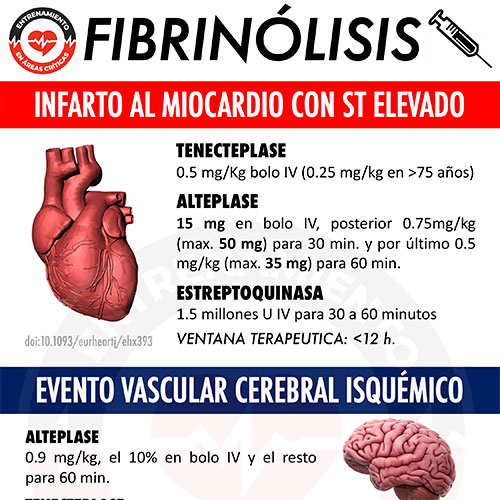 INFOGRAFÍAS INTENSIVEQARE