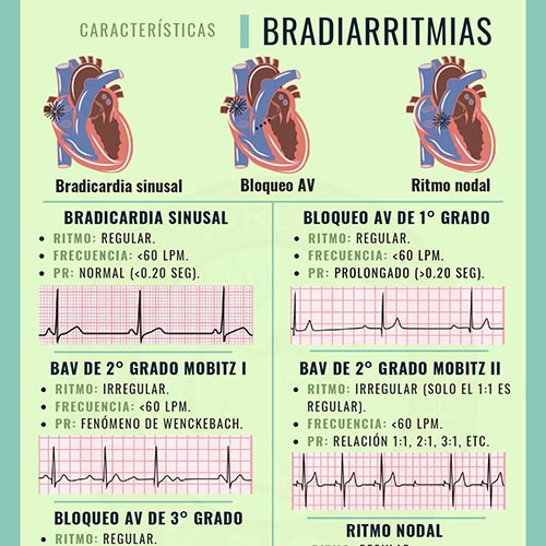 INFOGRAFÍAS INTENSIVEQARE