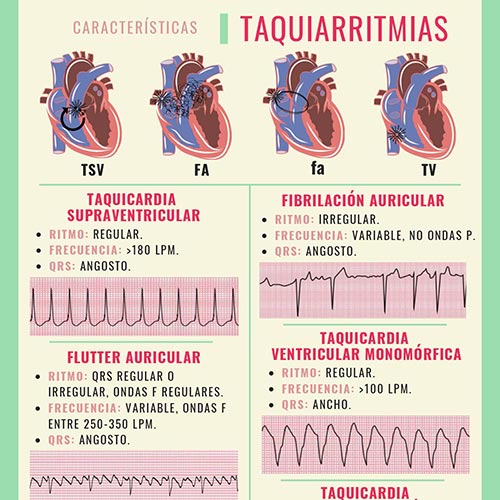 INFOGRAFÍAS INTENSIVEQARE