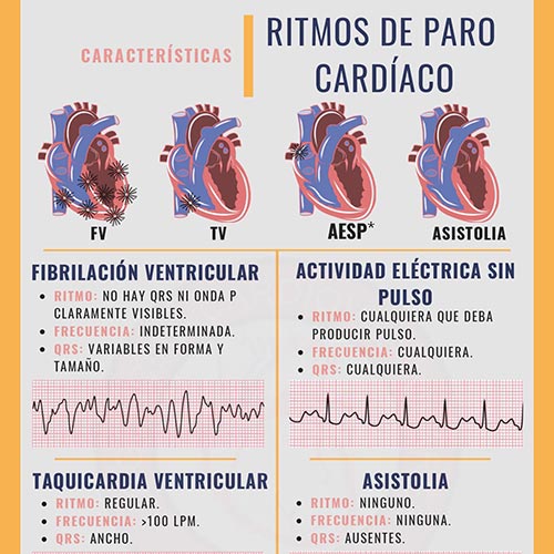 INFOGRAFÍAS INTENSIVEQARE